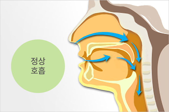 부천사과나무치과